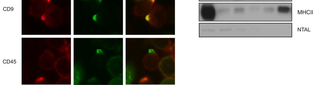Localization of CD9, ezrin (positive control) and CD45 (negative control) was detected with specific antibodies and common secondary antibody (GAM-A568). B.