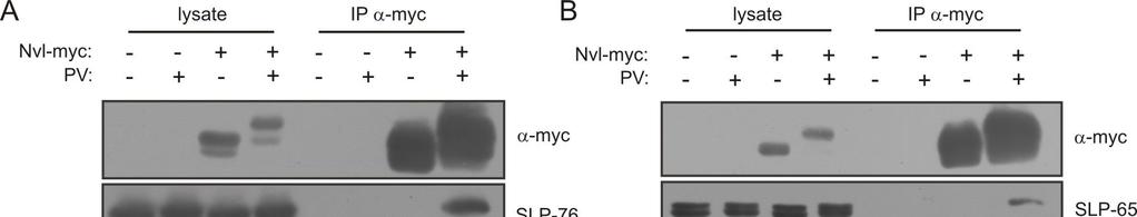 Interestingly, only the long form of SLP-65 was able to specifically associate with phosphorylated Nvl (Fig. 15B). Fig. 15 Proteins associated with phosphorylated form of Nvl A.