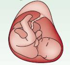 Lancet 1997;350:485-7) 11. 17.