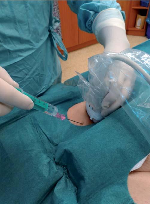 R. Špaček et al. 363 Úvod Kardiologie se v poslední dekádě vyprofilovala do vysoce invazivního oboru. Tento trend s sebou přinesl široké spektrum diagnostických a terapeutických výkonů.