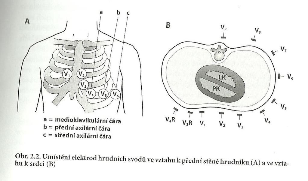 Na RTG snímku se projevuje plicní žilní městnání jako: 1. stupeň: cévní městnání 2. stupeň: intersticiální plicní otok 3. stupeň: alveolární plicní otok.