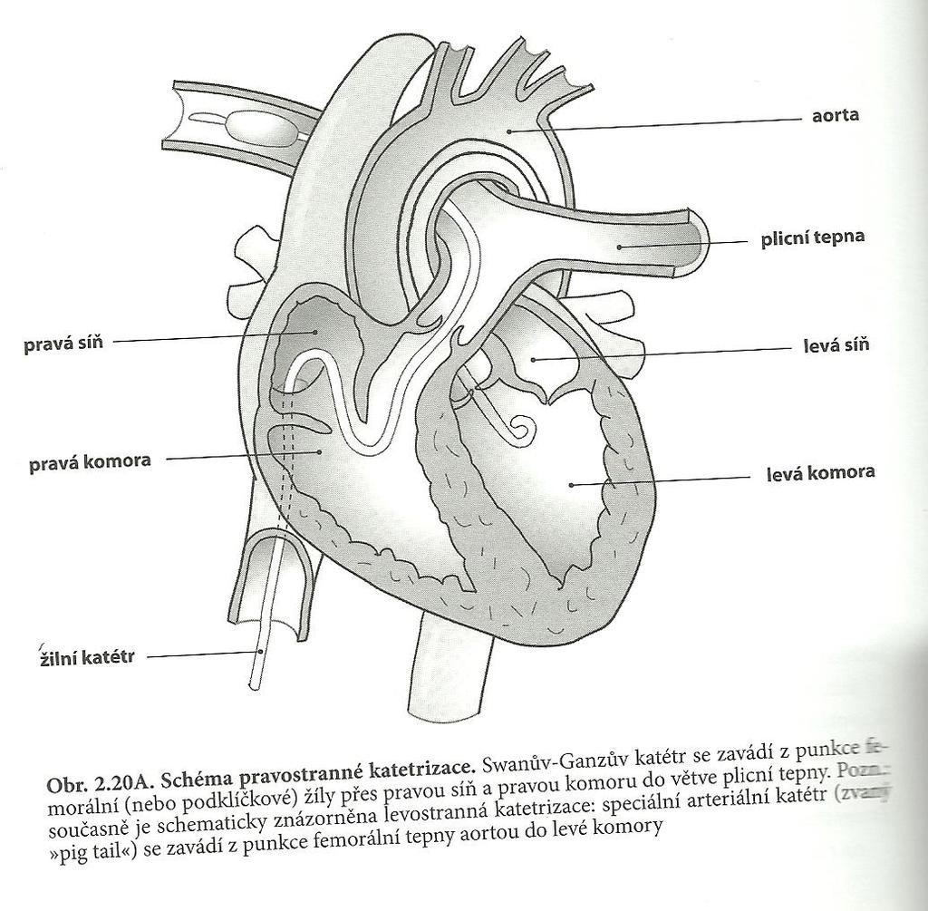 při níž jsou věnčité tepny znázorňovány rentgenograficky po nástřiku kontrastní látkou do jejich odstupu z aorty.