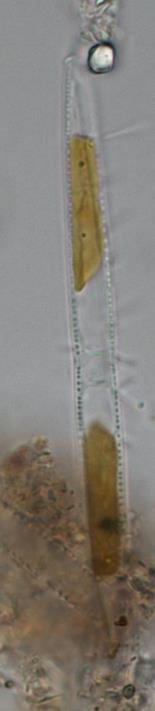 1 Nitzschia acicularis 2