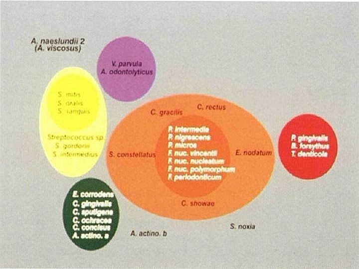 Vztah bakteriálních společenství k parodontitidě V.parvula A.odontolyticus Důležitý je hlavně tzv. červený komplex. S.mutans S.oralis S.sanguis E.corrodens C.gingivalis C.sputigena C.ochracea A.