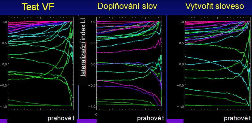 4) Lateralita verbálních funkcí Již předchozí text naznačil, že posouzení laterality vyjádřené pomocí LI je závislé na řadě okolností. Základní a celkem zřejmý bude vliv zvoleného typu stimulace.