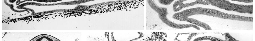 hlavové kavity, tedy párové epitheliální útvary mesodermálního původu situované v přední části vyvíjející se hlavy.