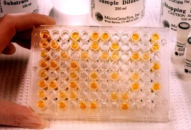 Cytokine assays ELISAs Radioimmunoassays + citlivé, kvantitativní metody - pouze průměrné množství cytokinů - neposkytují