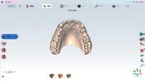 CAD/CAM technologie pro zubní laboratoře Pracovní