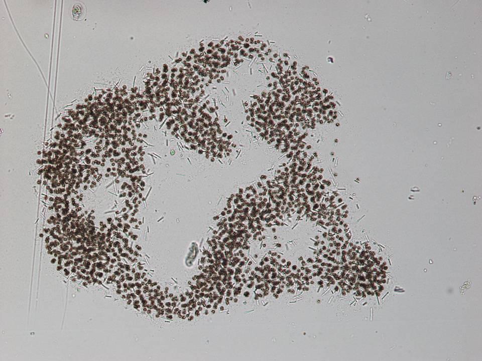 Microcystis aeruginosa