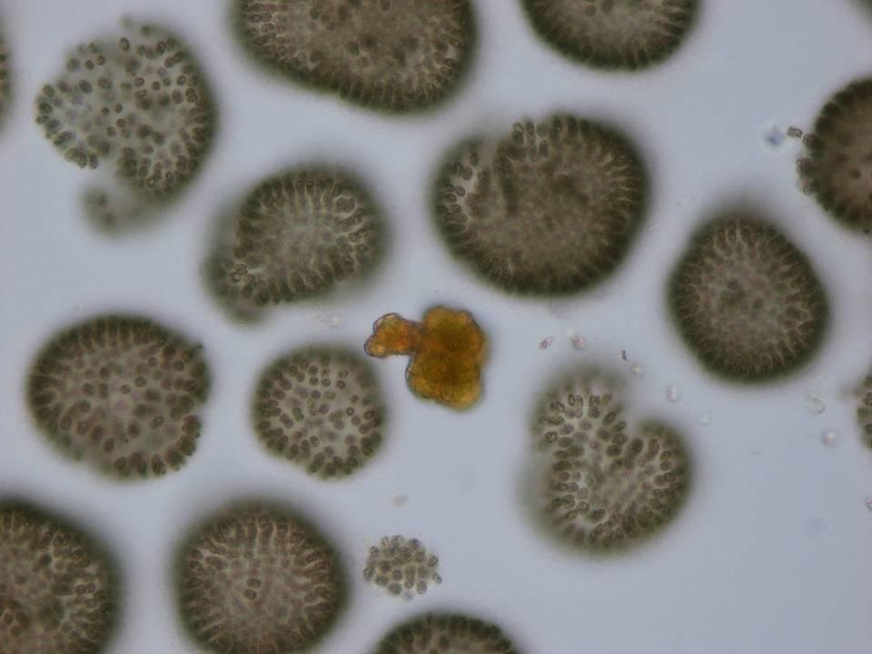 Woronichinia