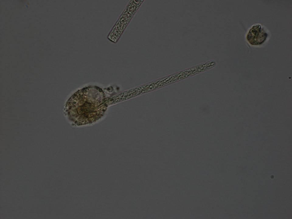 Planktothrix agardhii (s
