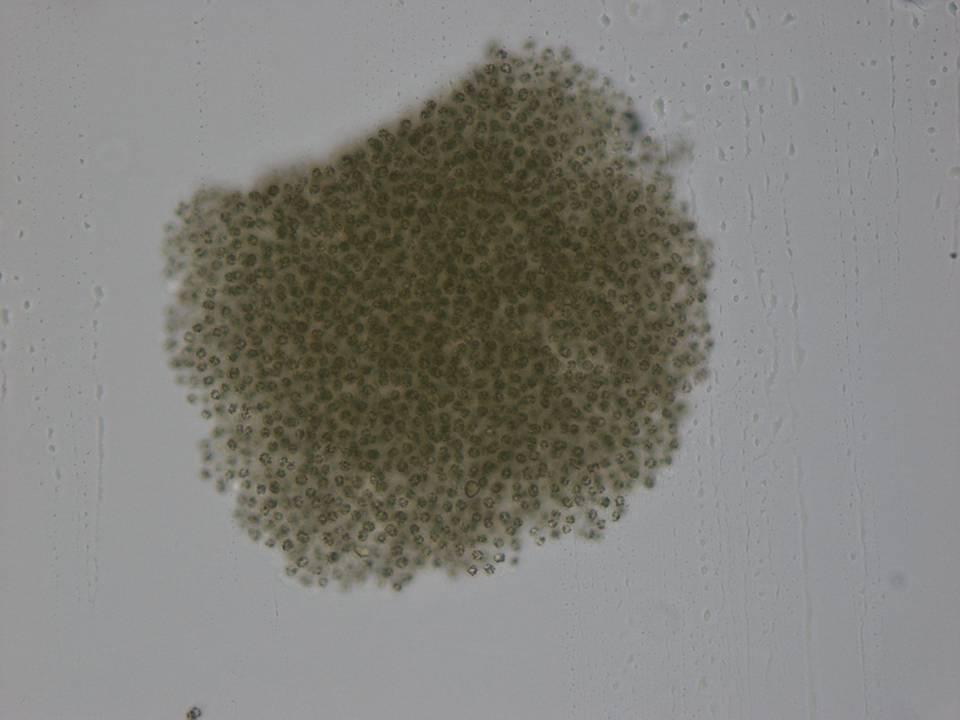 Microcystis