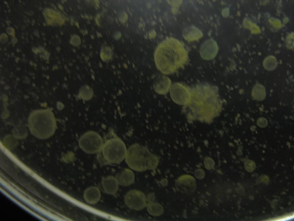 netypické kolonie Microcystis