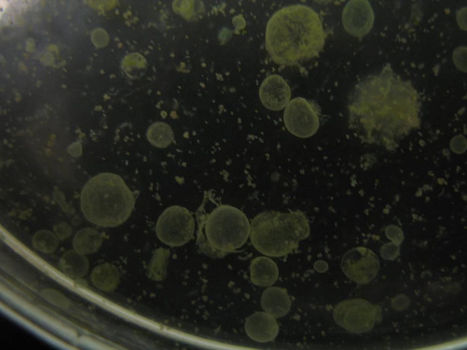 netypické kolonie Microcystis