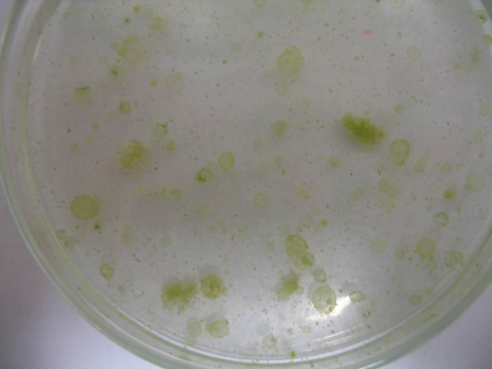 netypické kolonie Microcystis