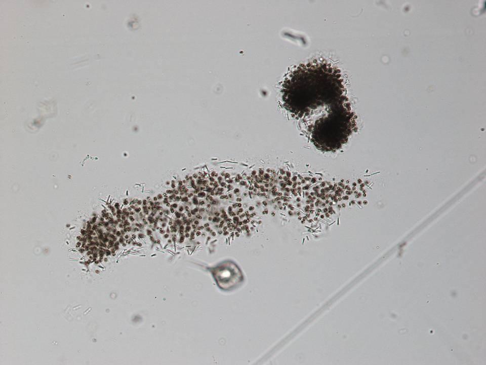 Microcystis aeruginosa