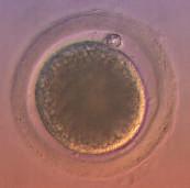 VÚVeL - Fest V Jak docílit úspěšné reprodukce u dojeného skotu Reprodukční biotechnologie - současné možnosti Laboratoř reprodukčních biotechnologií oddělení Genetiky a reprodukce Mgr.
