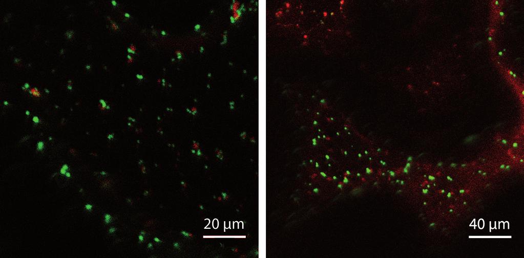 Proto byla provedena druhá tranzientní transformace Nicotiana benthamiana, tentokrát společně s konstrukty UBQ::YFP-EXO70H4 a 35S::ST-RFP.