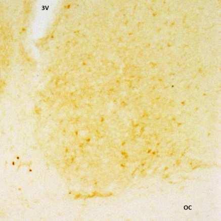 A B C Obrázek č. 11: Fotografie mediálních řezů SCN s maximální hladinou proteinu STAT3 v čase ZT4 (A), pstat3(s) v čase ZT16 (B) a pstat3(y) v čase ZT16 (C). OC optické chiasma, 3V 3. mozková komora.