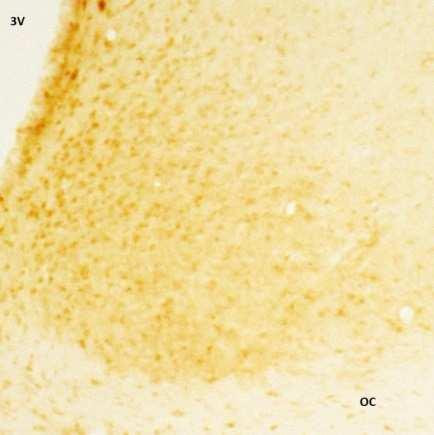 experimentu jsme také pomocí imunohistochemické metody zjišťovali, zda intraperinoneální aplikace leptinu ovlivní hladinu pstat3(s), pstat3(y), fosforylované formy ERK1/2 (perk1/2) a fosforylované