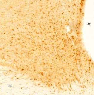 A vlscn - pgsk-3β - LEPTIN B dmscn - pgsk-3β - LEPTIN 140 140 120