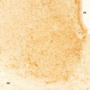 13: Vliv leptinu na hladinu pgsk-3β A ve vlscn a pgsk-3β B v dmscn