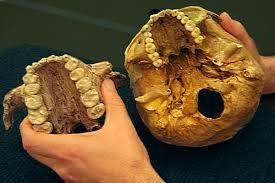 Paranthropus boisie