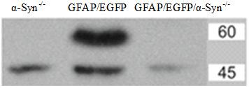 Abychom si ověřili, zda přenos delece genu pro α-syntrofin byl u GFAP/EGFP/ α-syn -/- myší úspěšný, použili jsme Western blot analýzu pro detekci přítomnosti proteinu α- syntrofinu (Obr. 19).