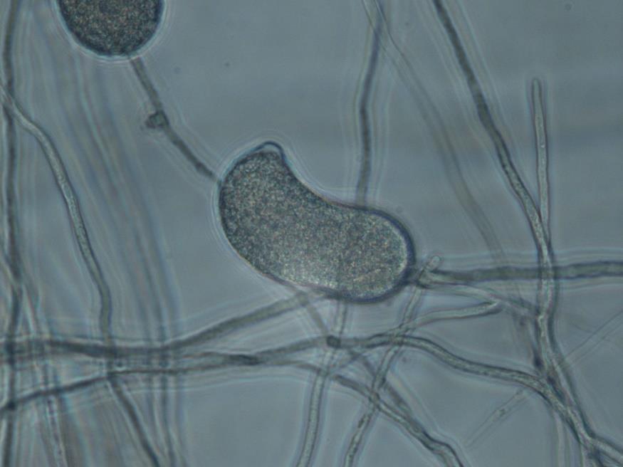 nalezeno 13 druhů plísní rodu Phytophthora Nebyly nalezeny