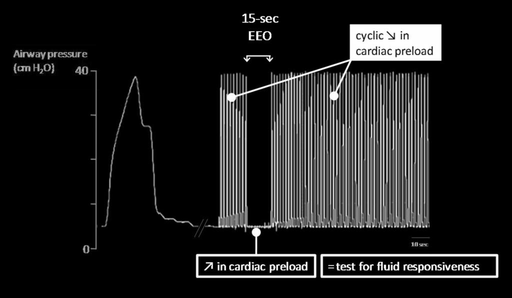 AL: Hemodynamic parameters to guide fluid therapy