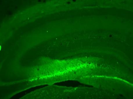 hippocampus