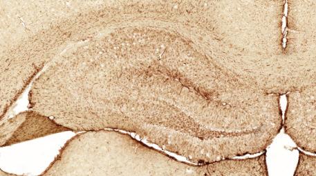 and antibodies