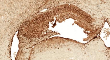 microglia