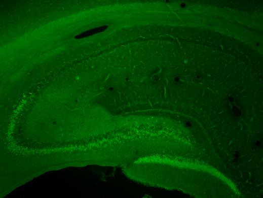 NMDA lesion 1 dpi NMDA lesion 3 dpi NMDA lesion 7 dpi NMDA