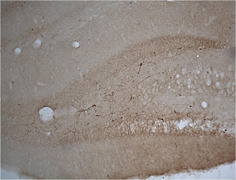time points (Fig. 22).