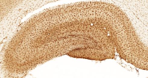 NMDA lesion SHAM lesion (PBS) 30 dpi 7 dpi 3 dpi 1 dpi Figure 24: Representative images of immunoperoxidase staining using anti-iba-1