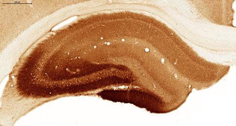 Figure 27: Quantitative analysis of immunoperoxidase staining relative optical density. Values for each hippocampus were normalized to neocortex.