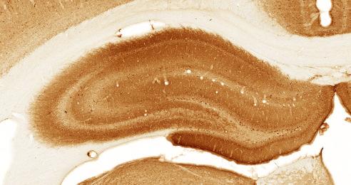 NMDA. We did not observe significant changes in PBS injected hippocampus; therefore only one representative picture is shown.