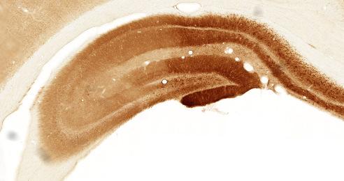 Figure 29: Quantitative analysis of immunoperoxidase staining relative optical density. Values for each hippocampus were normalized to neocortex. Values are given as mean ± SEM. * P < 0.05, ** P < 0.