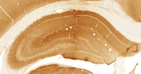 PBS group at 30 dpi. Expression of other subunits was not significantly decreased; however, we observed mild loss of immunoreactivity in lesion affected regions.