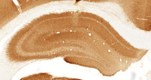 NMDA lesion 1dpi NMDA lesion 3dpi NMDA lesion 7dpi NMDA lesion 30dpi SHAM lesion (PBS) Figure 32: Representative images of immunoperoxidase staining using anti-gaba A