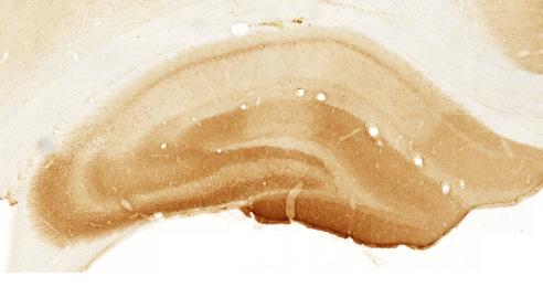 NMDA lesion 1dpi NMDA lesion 3dpi NMDA lesion 7dpi NMDA lesion 30dpi SHAM lesion (PBS) Figure 34: