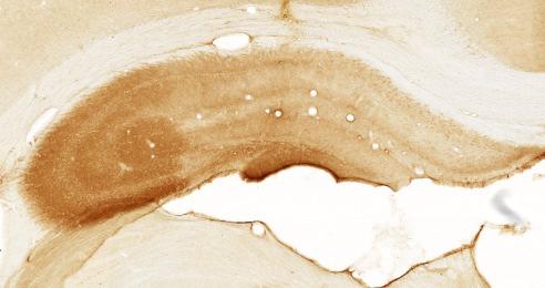 taken from the ipsilateral dorsal hippocampus at 1, 3, 7 or 30 days post injection (dpi) of NMDA.