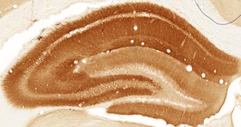 Figure 35: Quantitative analysis of immunoperoxidase staining relative optical density.