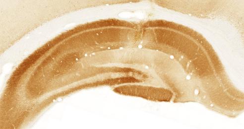 NMDA lesion 1dpi NMDA lesion 3dpi NMDA lesion 7dpi NMDA lesion 30dpi SHAM lesion (PBS) Figure 36: Representative images
