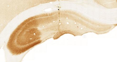 hippocampus at 1, 3, 7 or 30 days post injection (dpi) of NMDA.