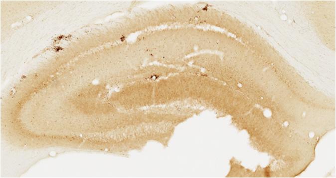 optical density (AU) 80 60 40 20 GABA A R γ2 ipsi NMDA PBS 0 1 3 7 30 dpi Figure 37: Quantitative analysis of immunoperoxidase staining relative optical density.
