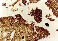 % 0 0 10 20 30 40 50 60 70 C in soil organic matter (tha-1) b earhthworm density ind m -2 % of worm cast in soil volume 40 35 30 25 20
