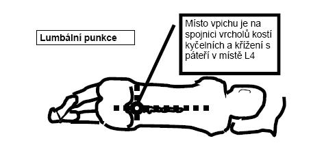 Ústav imunologie UK 2. LF a -Likvorová laboratoř Datum vydání: 7.5.2019 Verze: 8 Strana 11 (celkem 35) nastavenému vakuu.