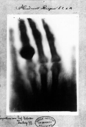 Fotografická detekce ionizujícího záření se také používá v průmyslové radiografii a
